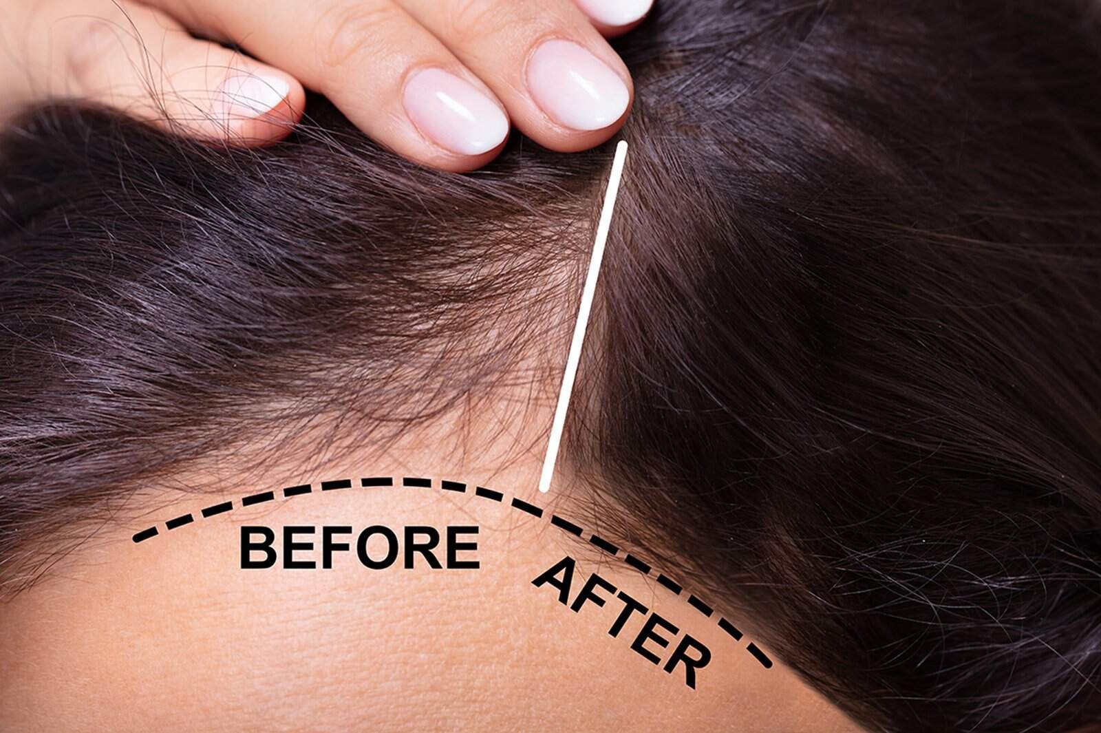 Thinning hair treatment and scalp care at Sasha Beauty Salon Dubai.